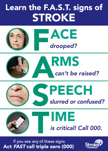 FAST stroke warning signs showing face drooping, arm weakness, speech difficulty and the need to act quickly.